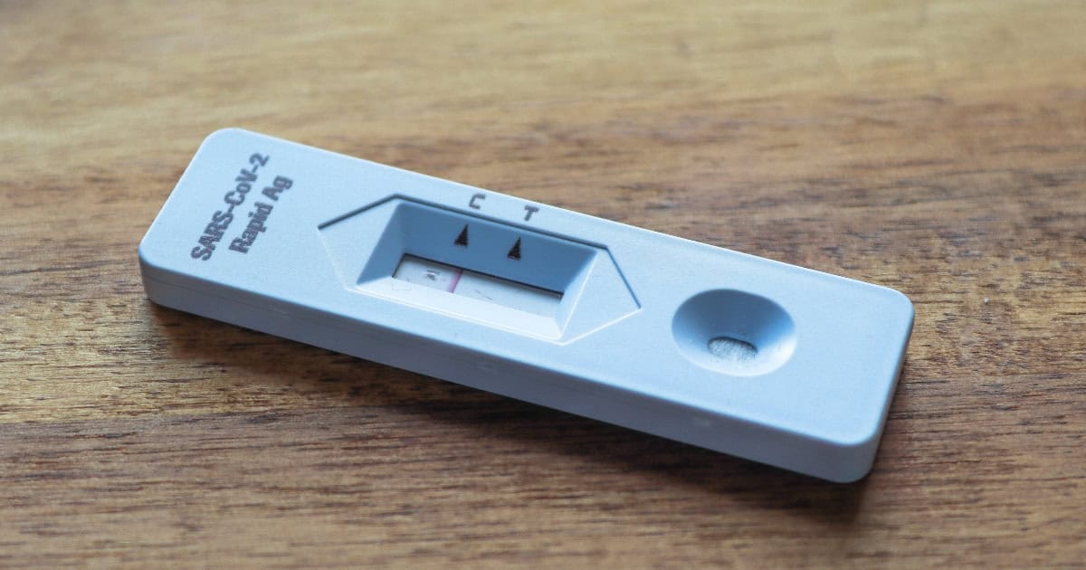 Amarante: Unidade Móvel de Testagem gratuita à COVID-19 vai percorrer mais freguesias