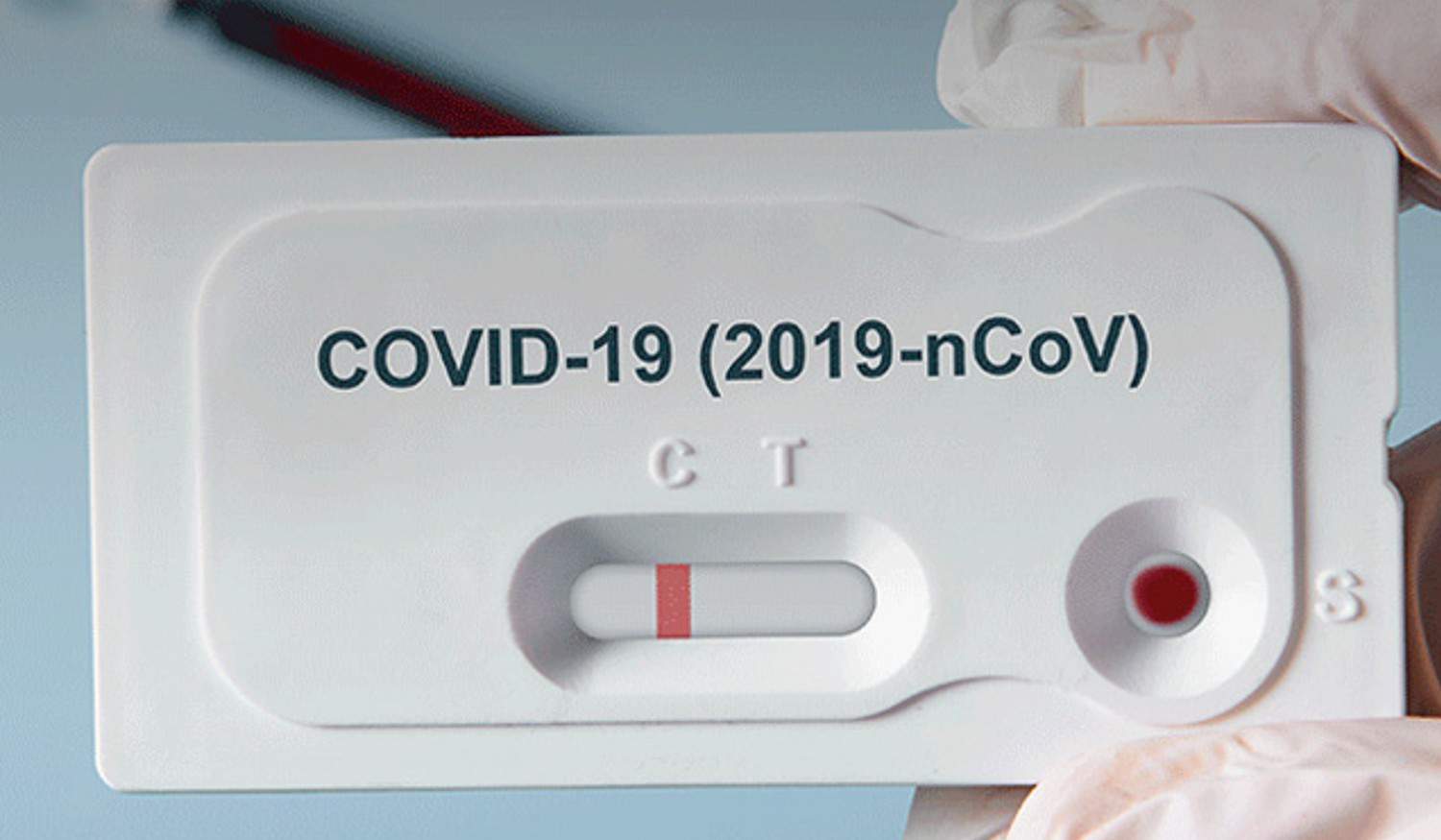 Centro de testagem de Paredes realiza testes antigénio gratuitos até ao final do mês de maio