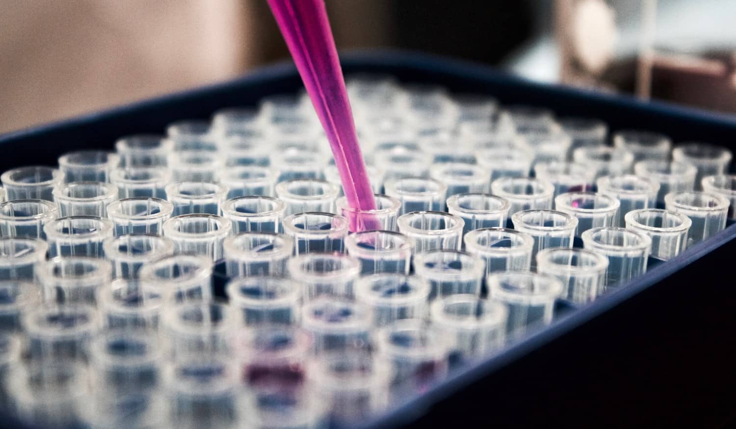 Cancro do colo do útero é "segunda causa de morte em mulheres com menos de 44 anos"