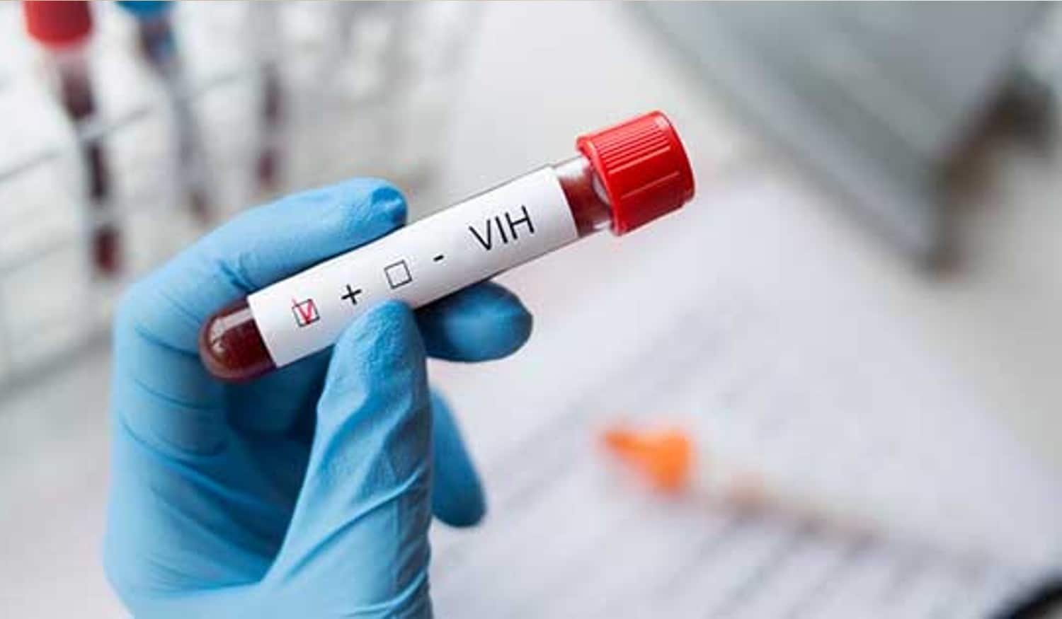 Semana Europeia da Primavera do Teste do VIH e Hepatites Virais promove rastreios por todo o país