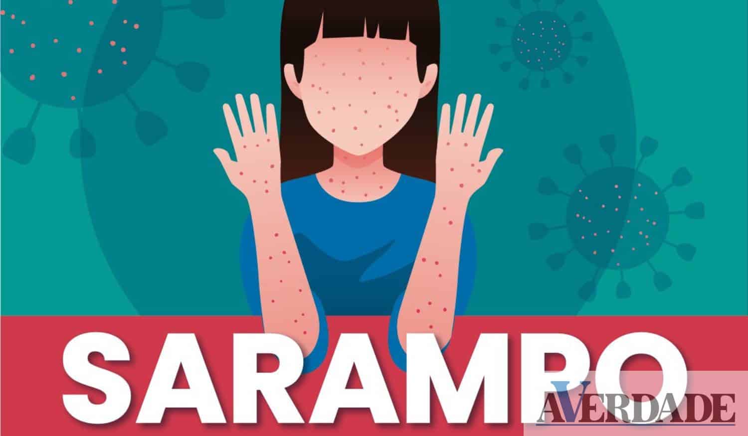 Sinais e sintomas de sarampo e que complicações pode trazer