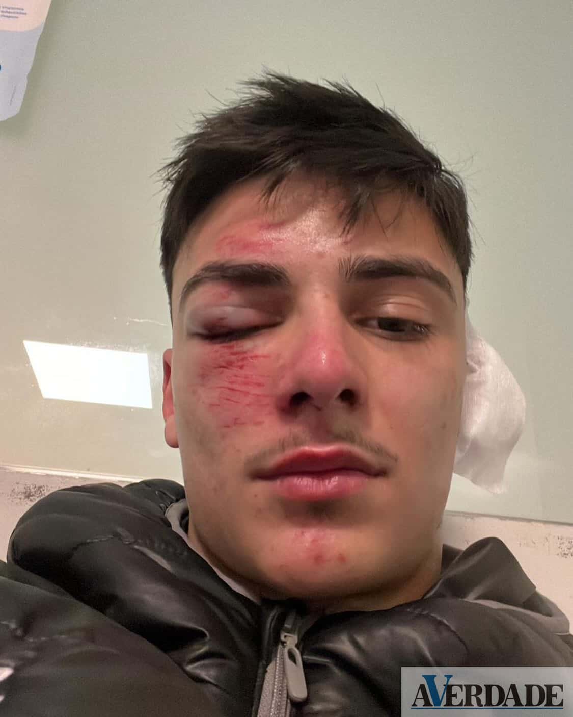 CRCD Varziela denuncia agressão e Aparecida FC pede desculpa pelo sucedido